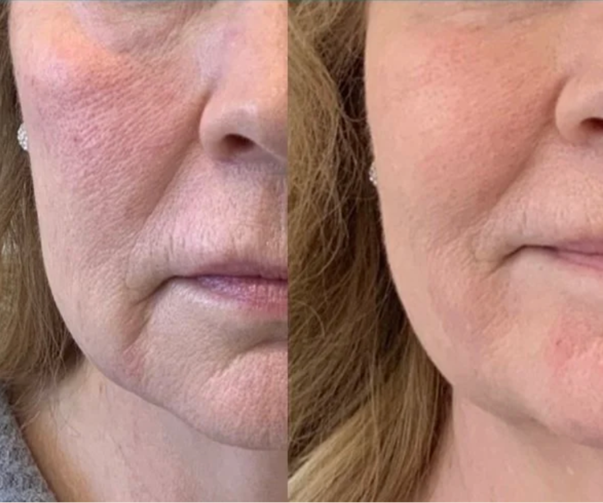 The Visible Lifting Set | Dandona